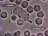 leukocyte-chasing-bacteria
